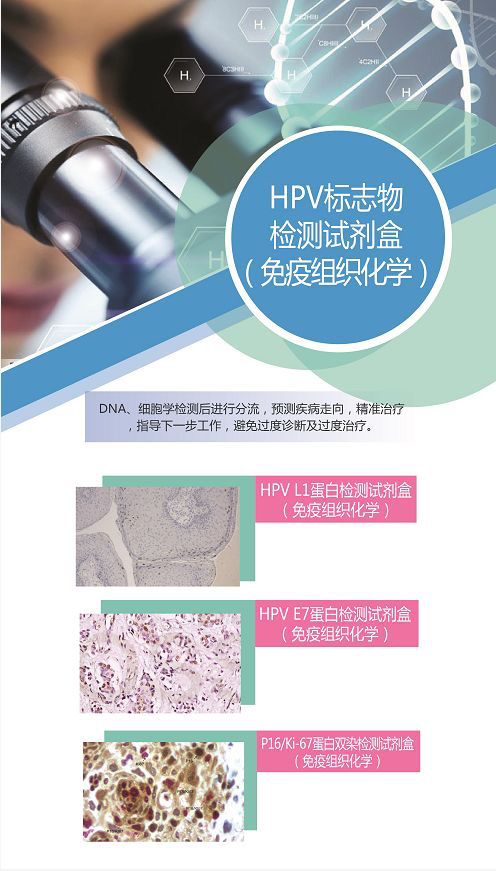 A better method for shunting patients with positive HPV screening6