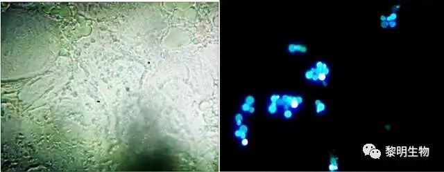 fungus-fluorescent-staining-solution-one-step-method-02
