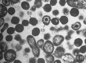 laboratory-diagnosis-of-chlamydia-trachomatis-infection