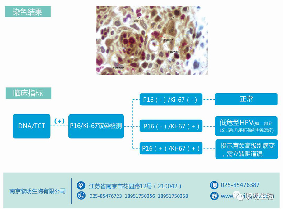 p16-ki67-5