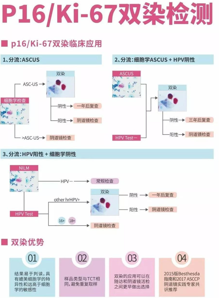 p16-ki67-6