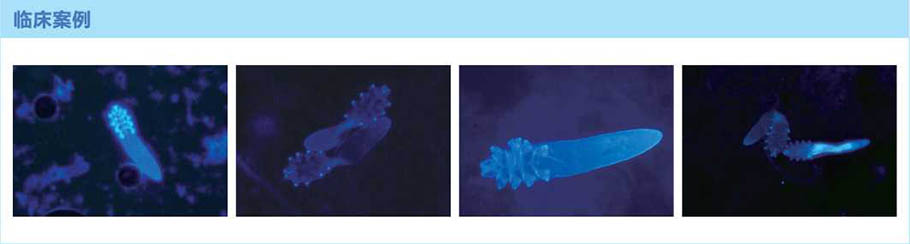 trichocarta-fluorescent-staining-solution2